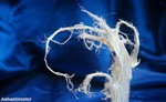 Asbestos may still be an issue in commercial property blocks